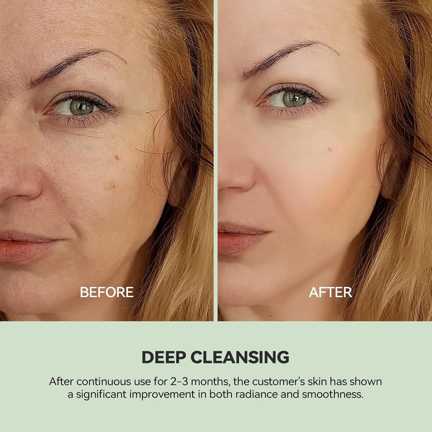 image:imageWNP Duo Cleansing Clay Mask with Niacinamide amp Hyaluronic Acid Deep Pore Cleanser for TZone amp UZone Blackhead Remover Hydrating amp OilControl Face Mask 353oz