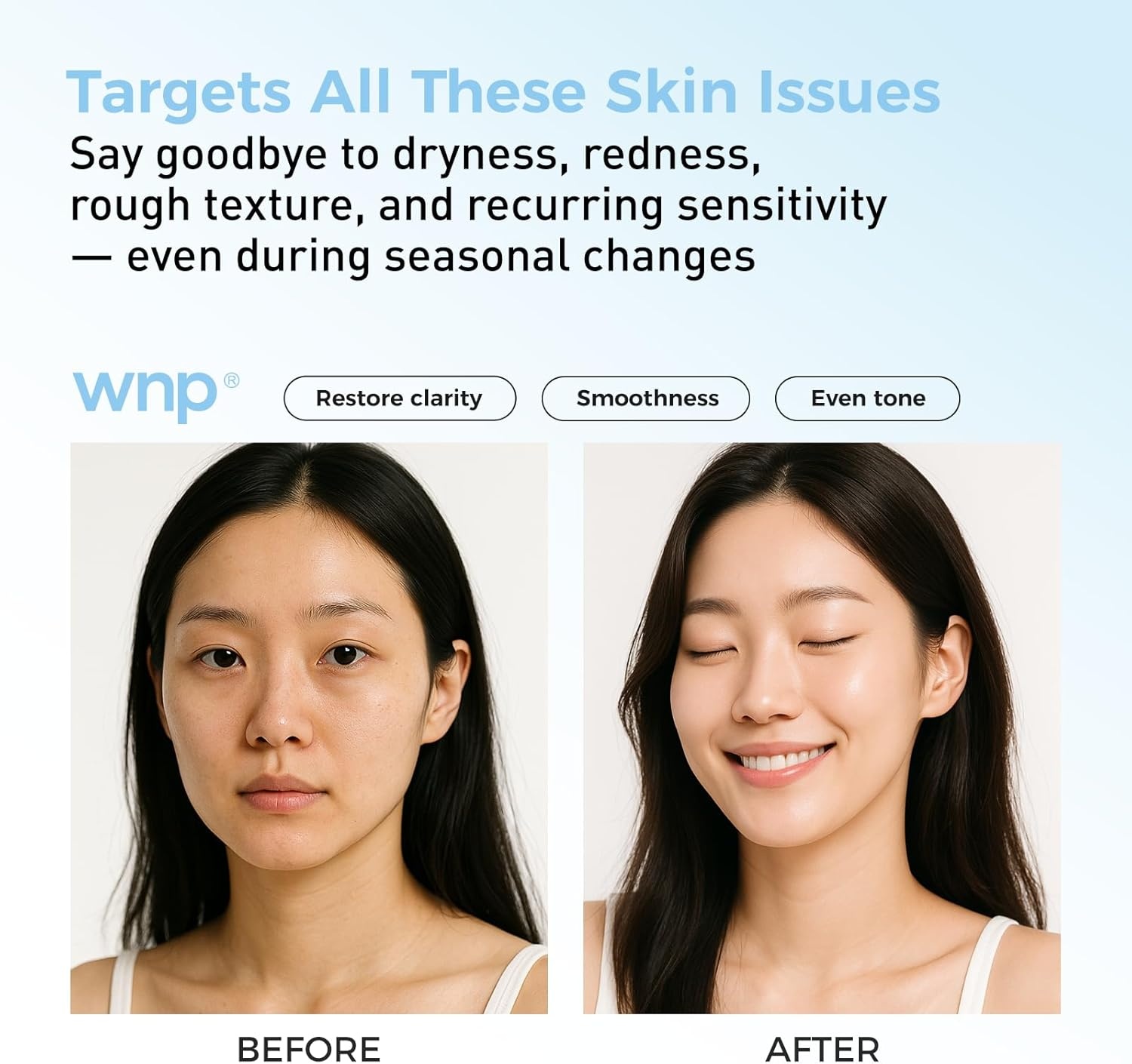 image:imageWNP Hyaluronic Acid HydratingampSoothing Toner 4D Hyaluronic AcidRed Algae ExtractBifida Ferment Lysate Panthenol Deep MoistureampSkin Barrier Repair Vegan Skincare for Dry amp Sensitive Skin