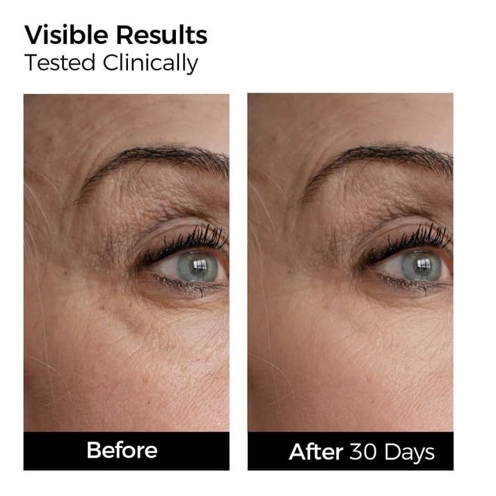 image:imageWNP Emergency Repair Serum Set Ultra 3 Hydrating Serum 4D Hyaluronic Acid Firming OilSuspension Serum SingleUse Skincare for Sensitive Skin 60 Vials